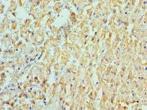 Polyclonal Rabbit anti-Human ADAM9 Antibody (aa475-685, IHC, WB)