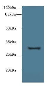 Polyclonal Rabbit anti-Human TMEM41A Antibody (IHC, WB)