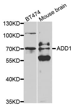 Polyclonal Rabbit anti-Human ADD1 / Adducin Alpha Antibody (IHC, WB)