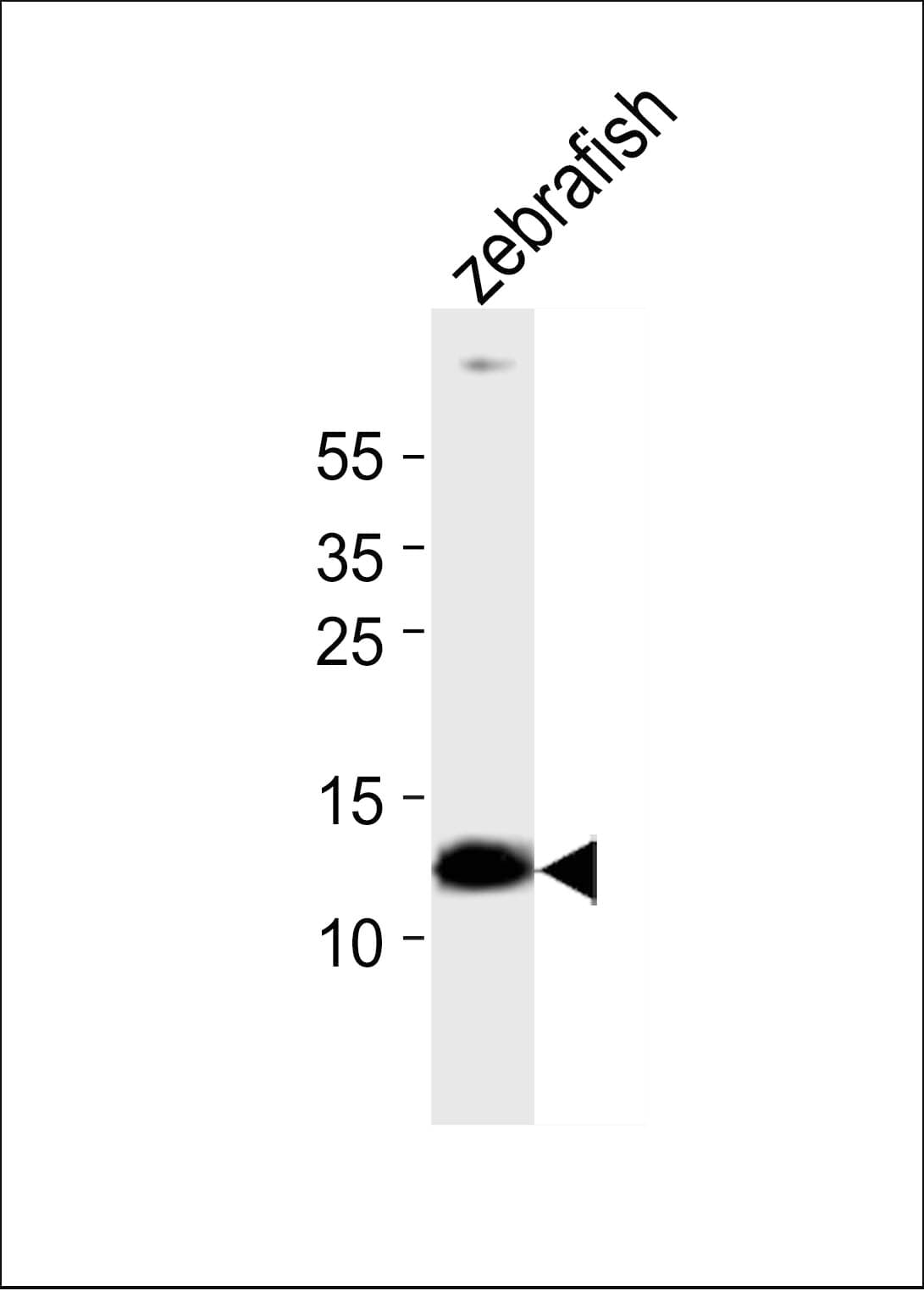 ba1 Antibody (aa93-126)