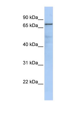 GMPS / GMP Synthase Antibody (aa251-300)