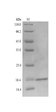 Epstein-Barr Virus LMP2 Protein (Recombinant 6His, N-terminus)