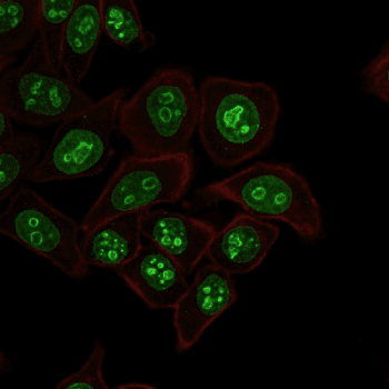 MKI67 / Ki67 Antibody (clone MKI67/2462)