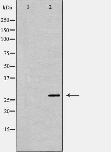 AREG / Amphiregulin Antibody