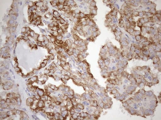 Monoclonal Mouse anti-Human NT5E / eNT / CD73 Antibody (clone OTI1G2, aa119-232, IHC, WB)