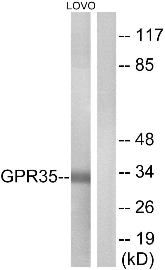 Polyclonal Rabbit anti-Human GPR35 Antibody (IF, WB)