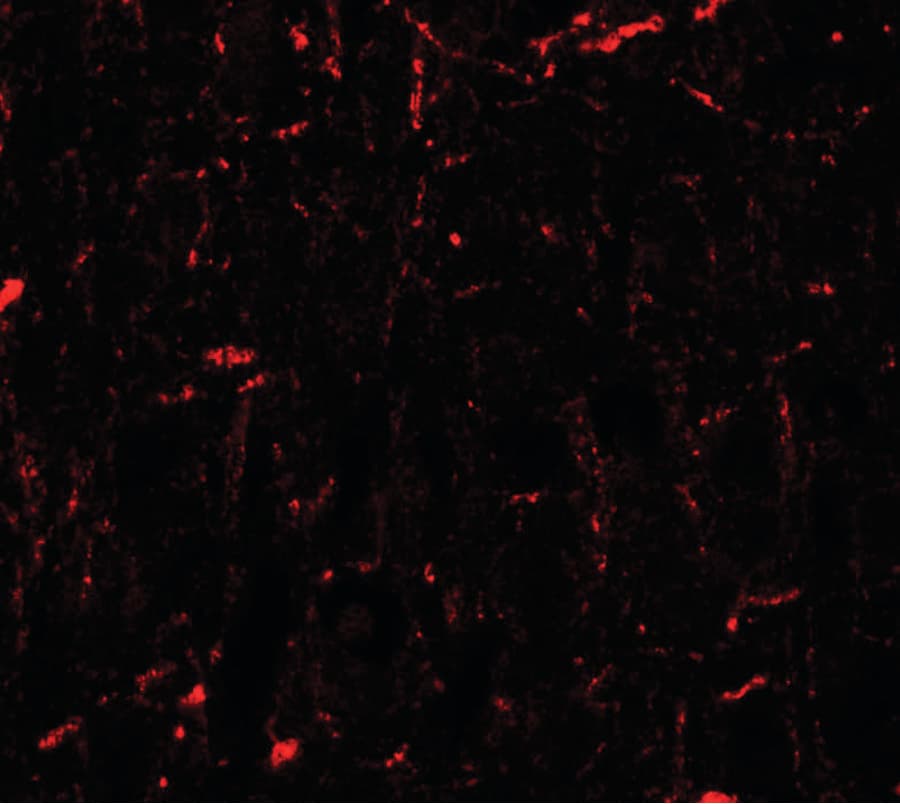 IHC-plus™ CCNT1 / Cyclin T1 Antibody