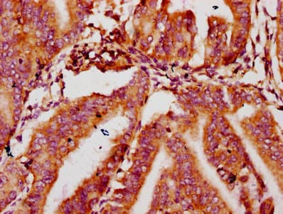 Polyclonal Rabbit anti-Human MTSS1 / MIM Antibody (IHC, WB)