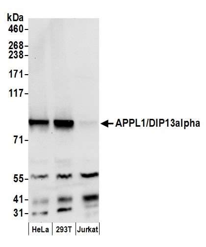 APPL1 / APPL Antibody (aa659-709)