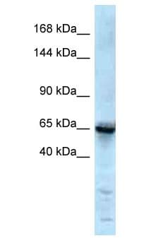 GRIK1 / GLUR5 Antibody (aa131-180)