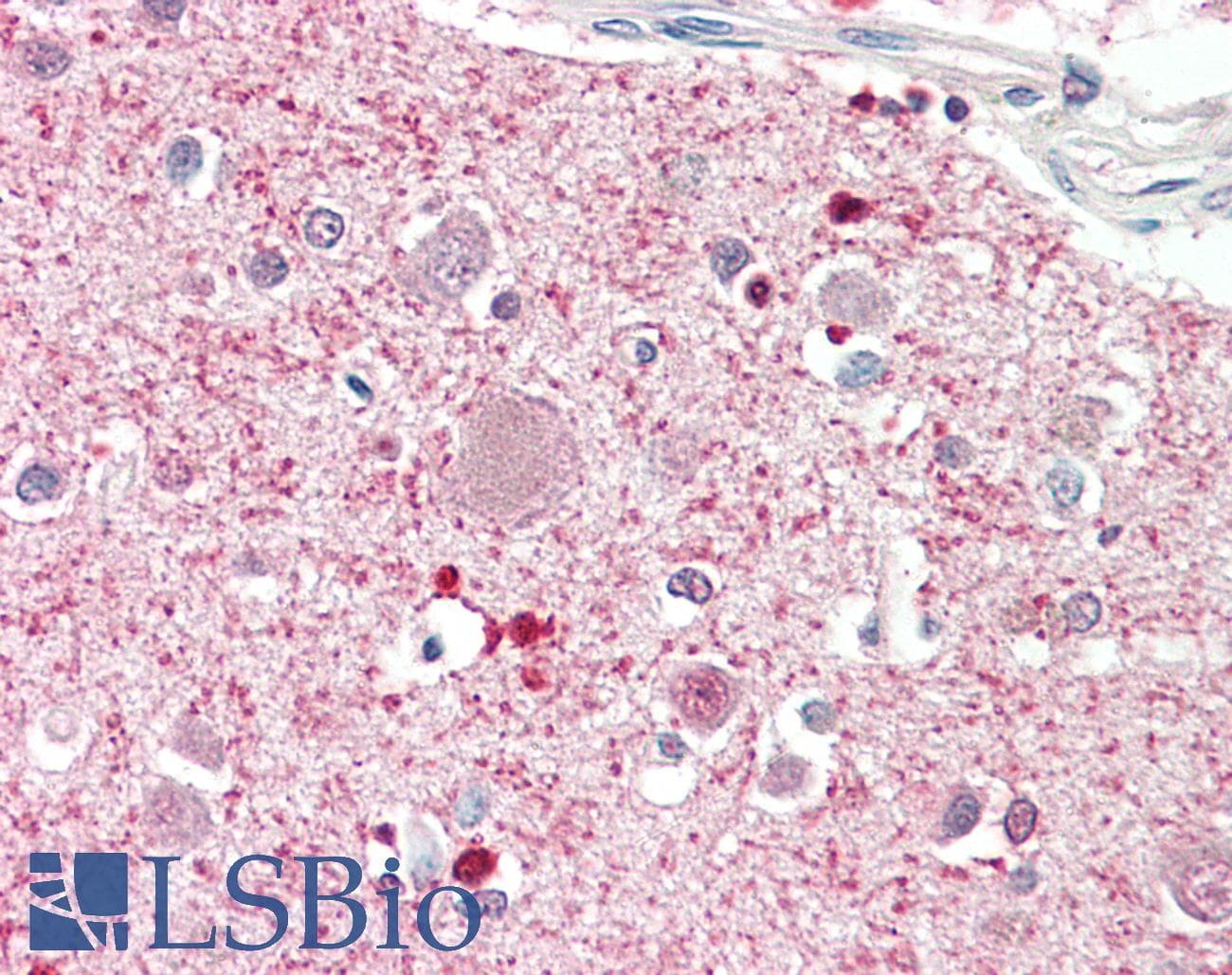 IHC-plus™ Polyclonal Goat anti-Human DGKQ Antibody (aa295-298, IHC)