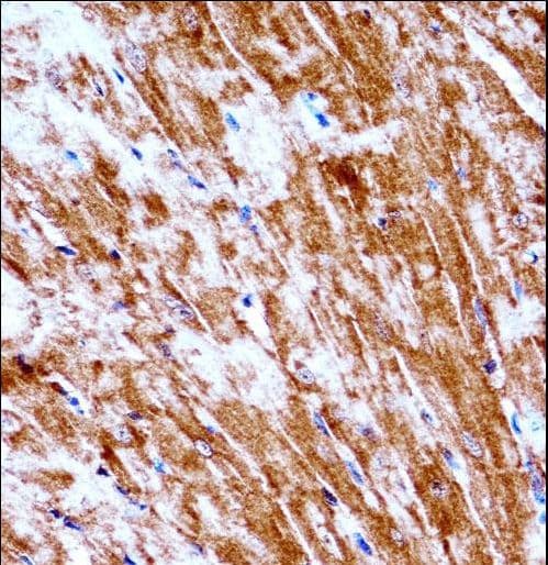 Polyclonal Rabbit anti-Mouse PDK2 Antibody (aa78-107, IHC, WB)