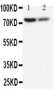 PMP70 Antibody (aa646-659)