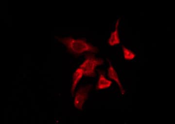 P2RY11 / P2Y11 Antibody