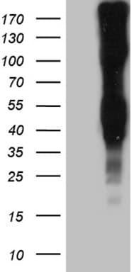 LY9 / CD229 Antibody (aa48-454, clone OTI2H4, Carrier-free)
