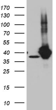 Monoclonal Mouse anti-Human GIPC1 / GIPC Antibody (clone OTI5C10, IHC, WB)