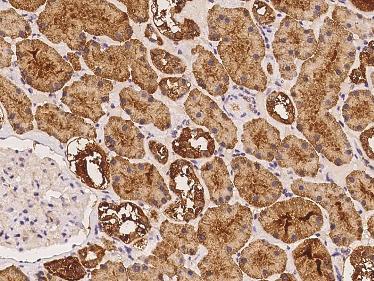 OR4K1 Antibody