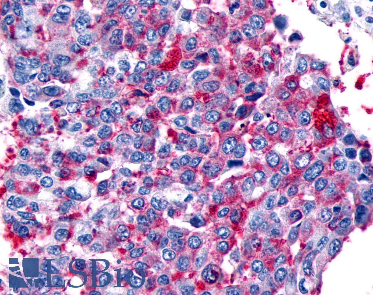 PathPlus™ FZD8 / Frizzled 8 Antibody (N-Terminus)