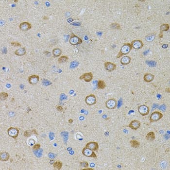 PFKP Antibody