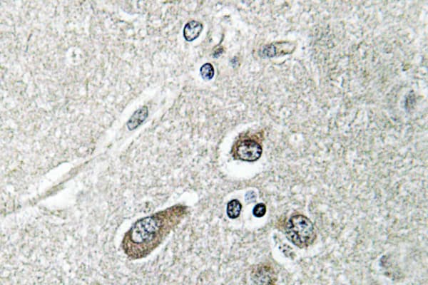 Polyclonal Rabbit anti-Human ACSL6 Antibody (Asp531, IHC, WB)