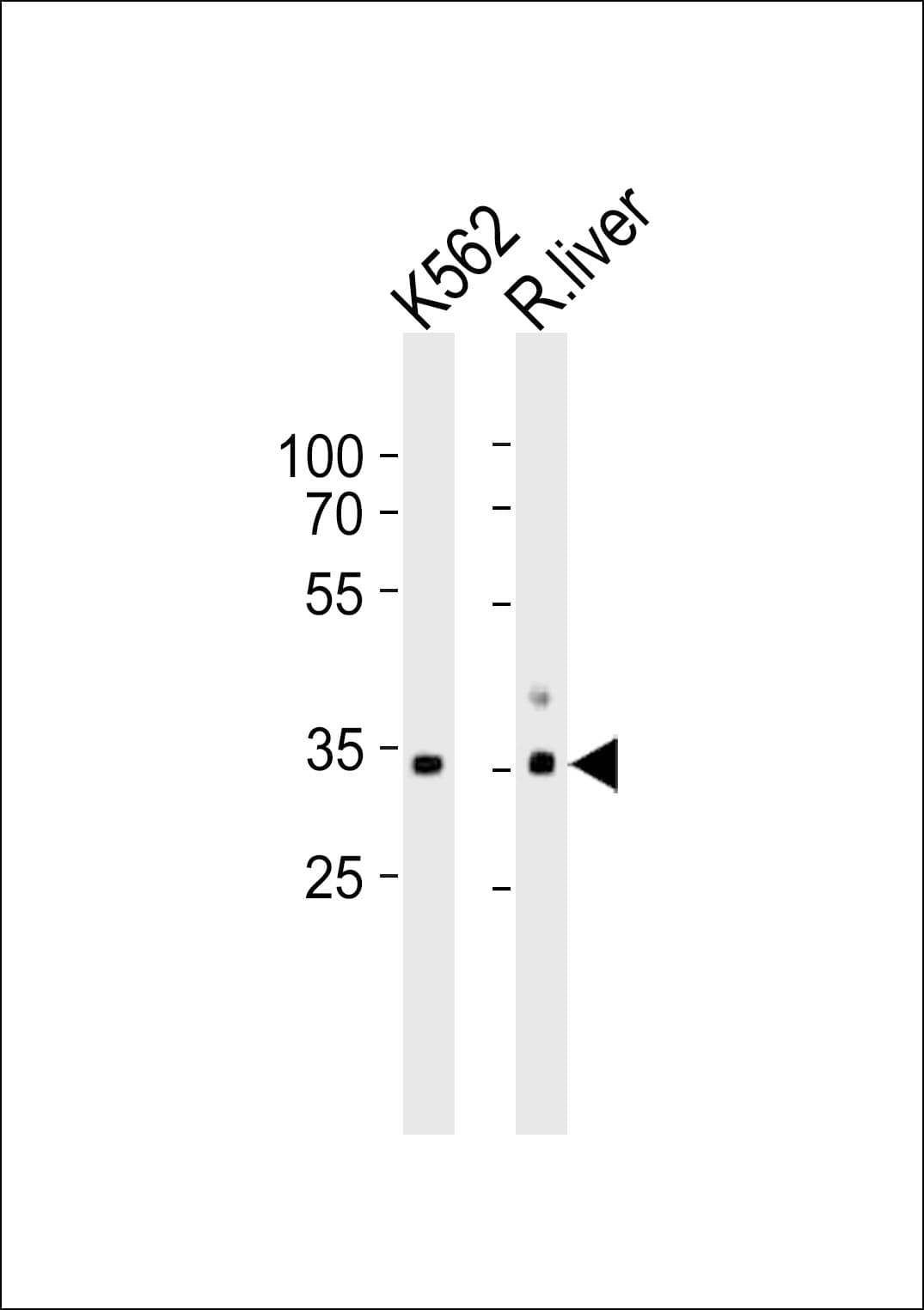 IHC-plus™ AMOG / ATP1B2 Antibody (aa115-141)