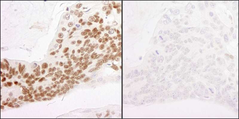 POLR2A / RNA polymerase II Antibody (phospho-Ser2)