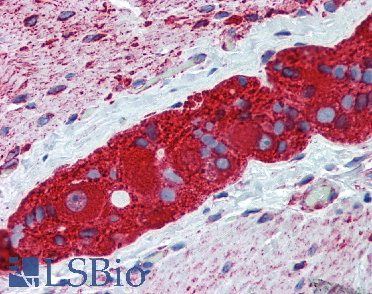 IHC-plus™ TUBB2A / Tubulin Beta 2A Antibody (clone 3B2)