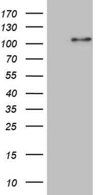 NSD3 / WHSC1L1 Antibody (aa427-566, clone OTI1F11)