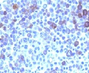 GPC3 / Glypican 3 Antibody (clone GPC3/863, Ready-to-Use)