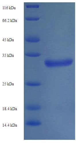 Human Trimethylguanosine Synthase 1 Protein (Recombinant His-SUMO)