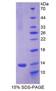 Mouse CXCL4 / PF4 Protein (Recombinant His-T7)