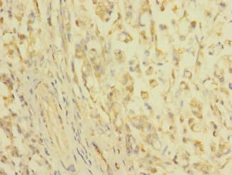 Polyclonal Rabbit anti-Human CLDN18 / Claudin 18 Antibody (IHC, WB)