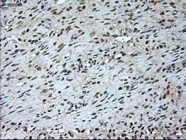 Monoclonal Mouse anti-Human GAD1 / GAD67 Antibody (clone OTI3G9, IHC, WB)