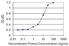Monoclonal Mouse anti-Human RARRES1 Antibody (clone 2E2, WB)