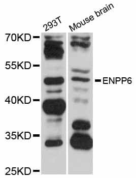 Polyclonal Rabbit anti-Human ENPP6 Antibody (WB)