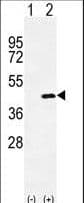 IHC-plus™ Polyclonal Rabbit anti-Human Osteoglycin / Mimecan Antibody (aa246-276, IHC, WB)