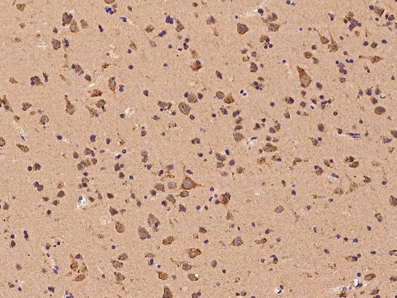 Polyclonal Rabbit anti-Human RORB / ROR Beta Antibody (IHC)