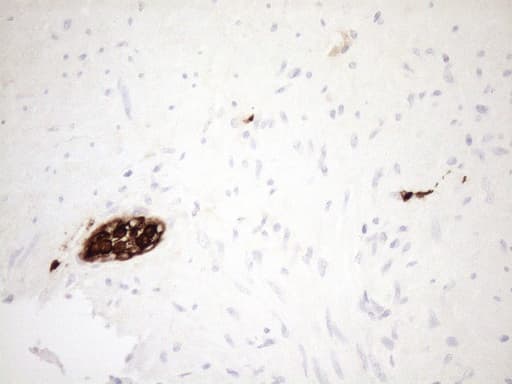 S100A9 / MRP14 Antibody (clone OTI13E12)
