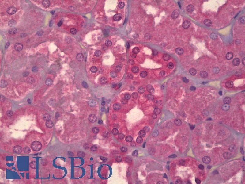 IHC-plus™ Monoclonal Mouse anti-Human MAPK8 / JNK1 Antibody (clone 4H5, IHC, WB)