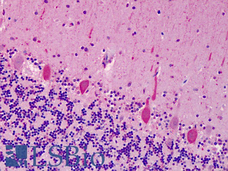 IHC-plus™ ACCN1 / ASIC2 Antibody (aa15-26)