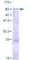 Human GCL / Grancalcin Protein (Recombinant GST)