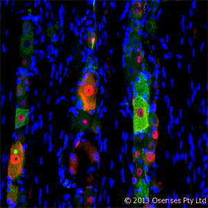 NGFR / CD271 / TNR16 Antibody (clone MC192)