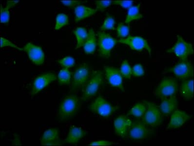 Polyclonal Rabbit anti-Human PHACTR1 Antibody (IHC, IF, WB)