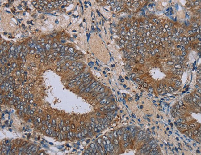 IFRD1 / TIS7 Antibody