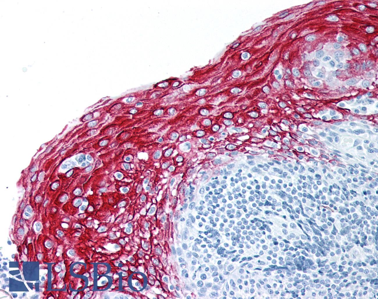 PathPlus™ KRT6A / CK6A / Cytokeratin 6A Antibody