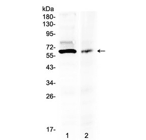 AMH / Anti-Mullerian Hormone Antibody