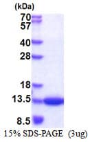 Human CKS1B / CKS1 Protein (Recombinant His)
