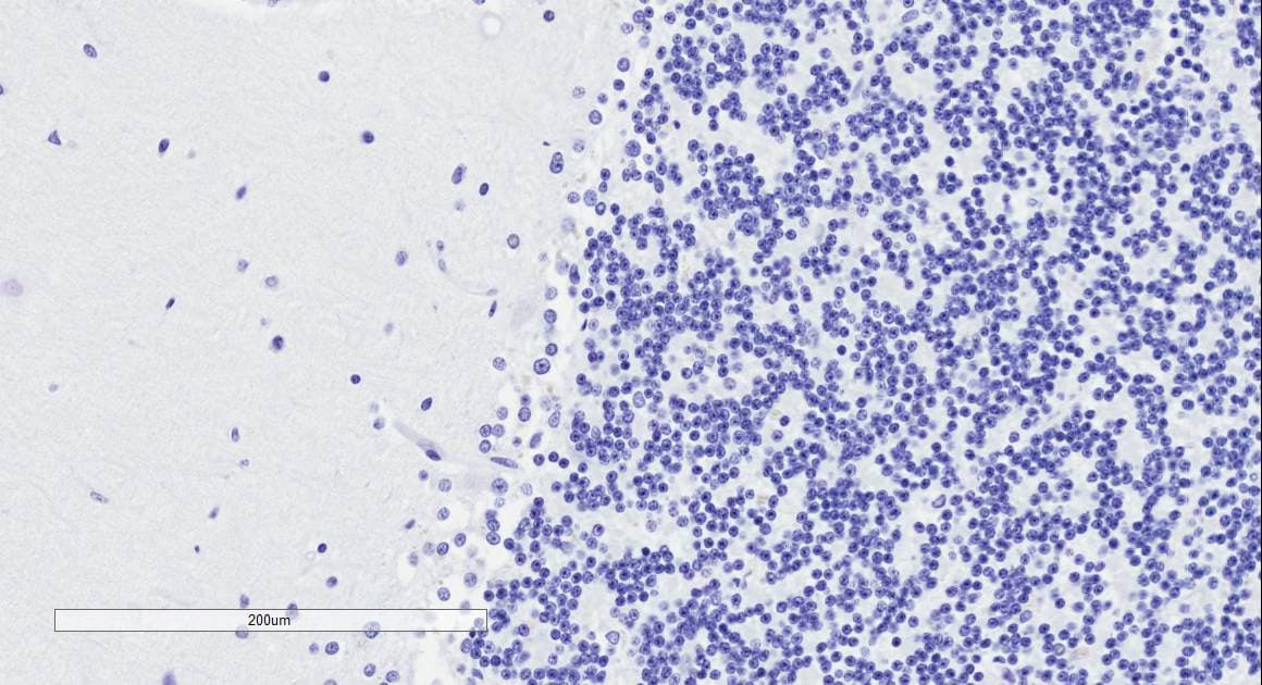 DCX / Doublecortin Antibody (aa232-242)