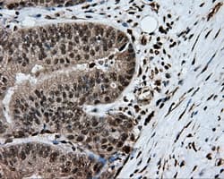 HMRF1L / MTRF1L Antibody (clone OTI1E3)