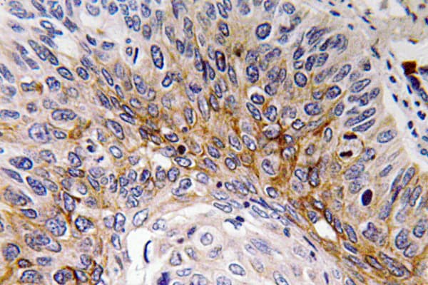 Polyclonal Rabbit anti-Human CTF1 / Cardiotrophin-1 Antibody (aa31-80, IHC, WB)